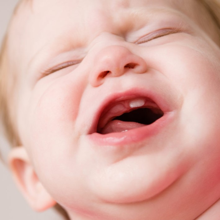 bebe chorando na consulta do dentista